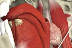 Evacuação da Voz:4 - Mecanismos da Voz Humana
